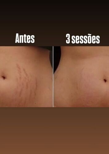Antes e depois